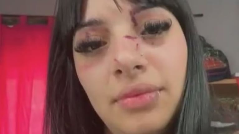 Chica golpeada por linda.