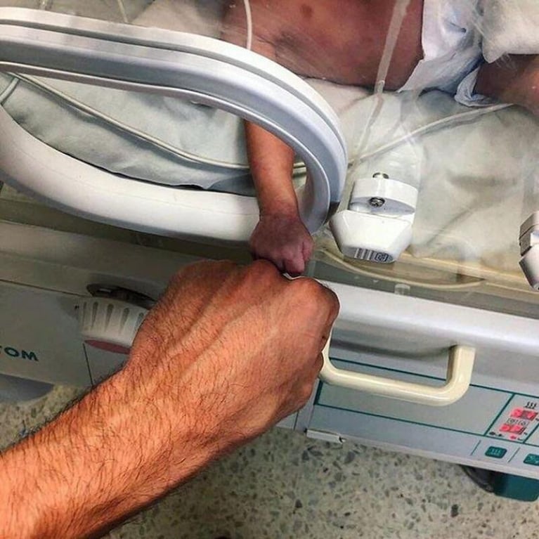 Choque de puños: la tierna foto de un médico y un bebé prematuro