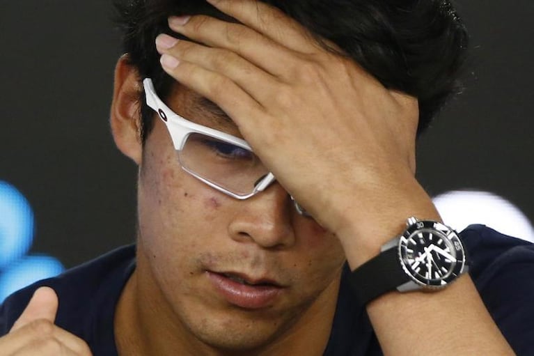 Chung debió abandonar contra Federer por una ampolla gigante 