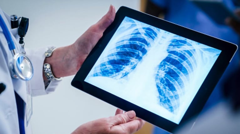 Científicos de EE.UU y Dinamarca hallaron vínculos entre su estado y la longevidad.