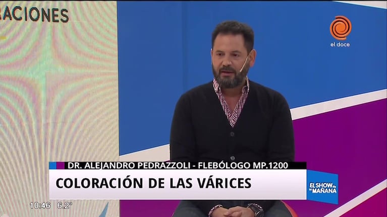 Coloración de las várices y otros trastornos vasculares