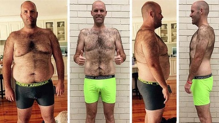 Comió solo papas durante un año y bajó 53 kilos