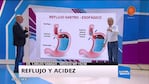 ¿Cómo combatir el Reflujo y la acidez?