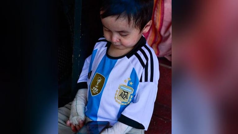"Conocer a Messi”: el nene cordobés con piel de cristal que conmueve con su sueño