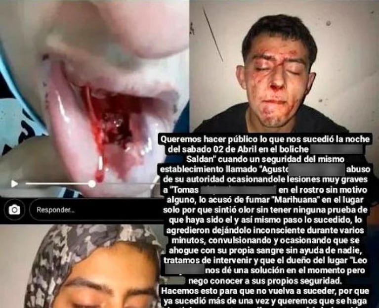 Córdoba: denuncia que un patovica le dio una golpiza dentro de un boliche