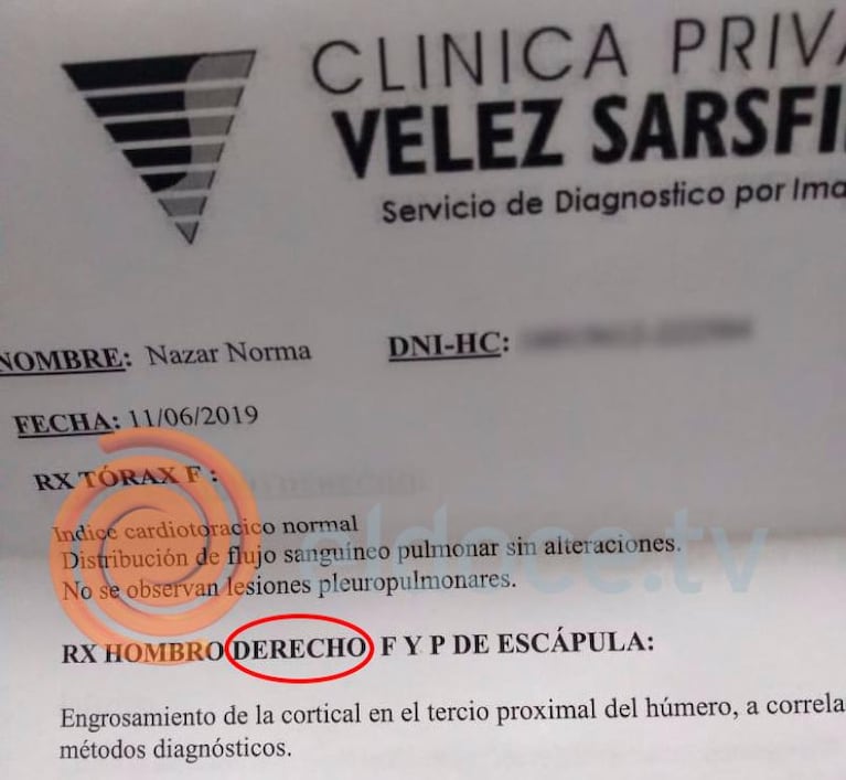 Córdoba: tiene un tumor en el hombro derecho, pero la operaron del izquierdo