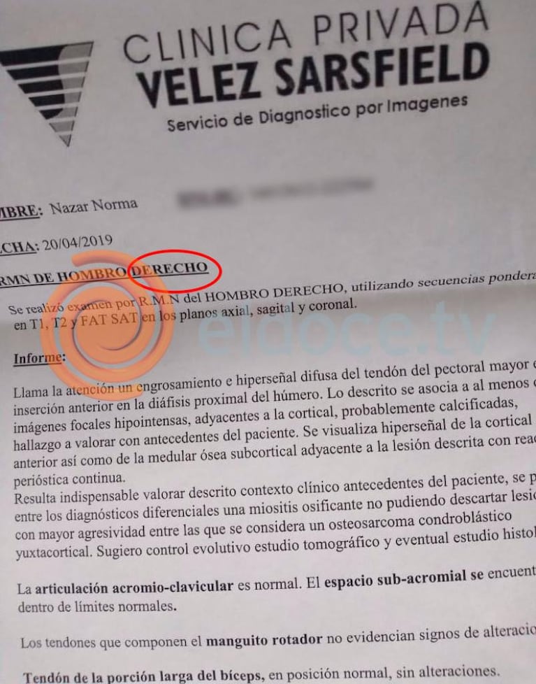 Córdoba: tiene un tumor en el hombro derecho, pero la operaron del izquierdo