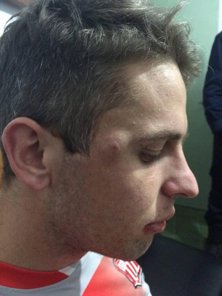 Córdoba: tremenda agresión entre futbolistas