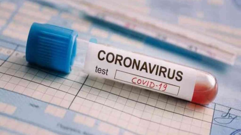 Coronavirus: 795 nuevos casos en Argentina, pero ninguno en Córdoba