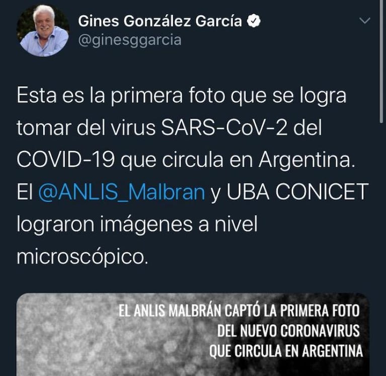 Coronavirus: fotografiaron por primera vez la cepa que circula en Argentina