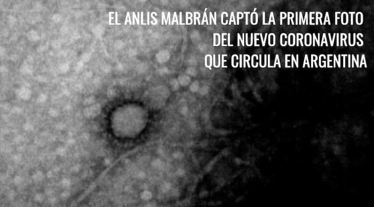 Coronavirus: fotografiaron por primera vez la cepa que circula en Argentina