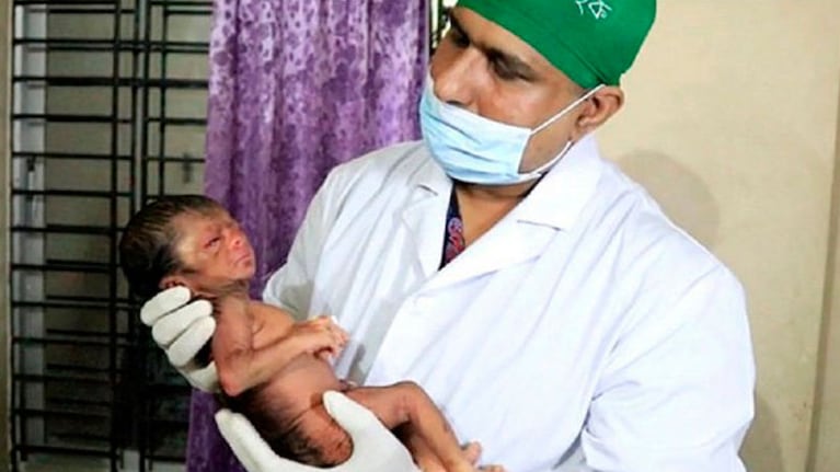De la ficción a la realidad: tiene la enfermedad de Benjamin Button.