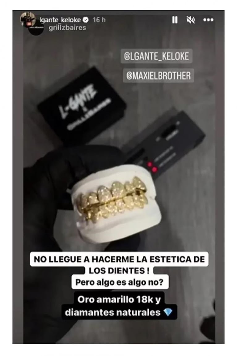 De oro y diamantes: L-Gante mostró su nueva dentadura