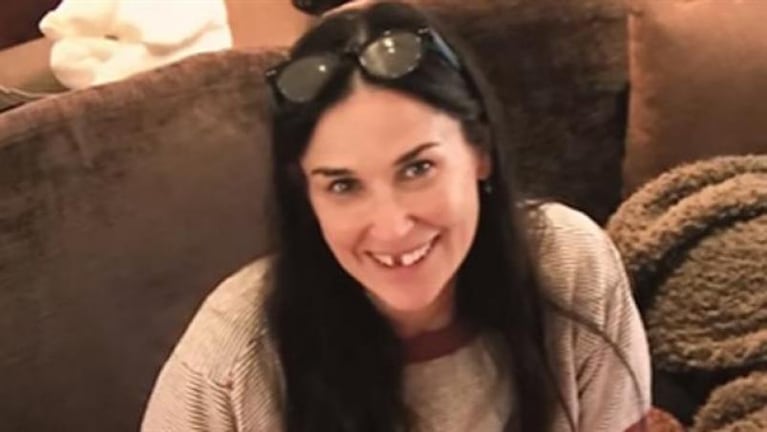 Demi Moore contó porqué perdió dos dientes 