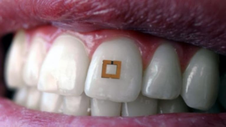 Desarrollaron un chip dental para controlar lo que comemos