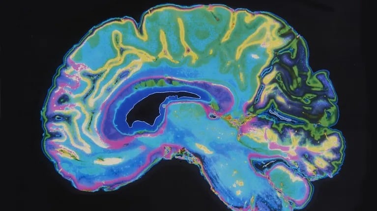 Descubren una sorprendente causa por la que la memoria se deteriora con el paso de los años 