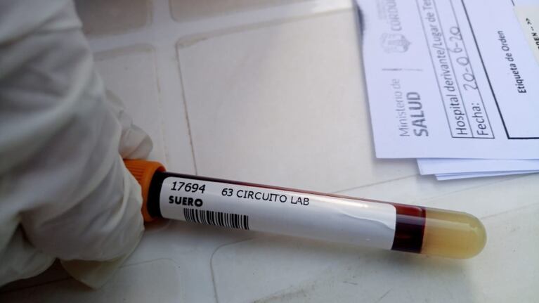 Desde que comenzó la pandemia, se registraron 555 personas contagiadas en Córdoba, 349 se recuperaron.