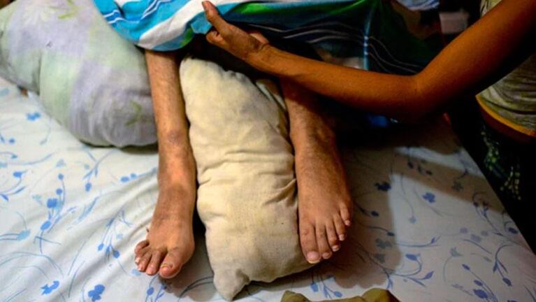 Desesperado: un cuadripléjico reclama la eutanasia a Maduro