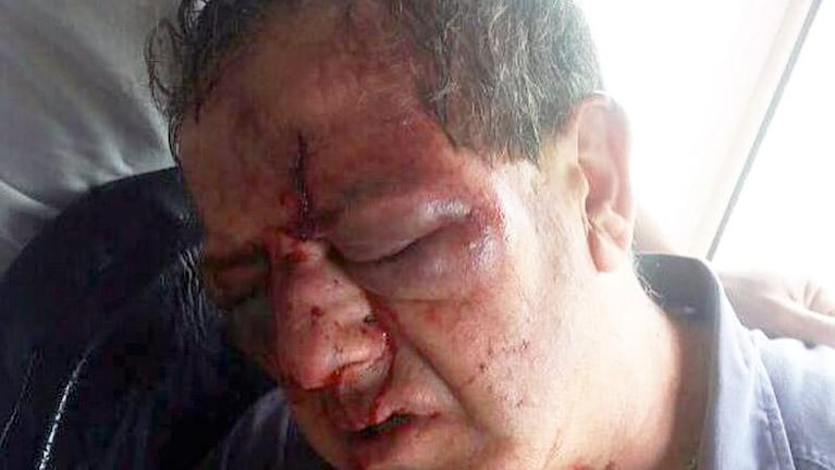 Detienen a un boxeador por el ataque al maquinista en Malagüeño