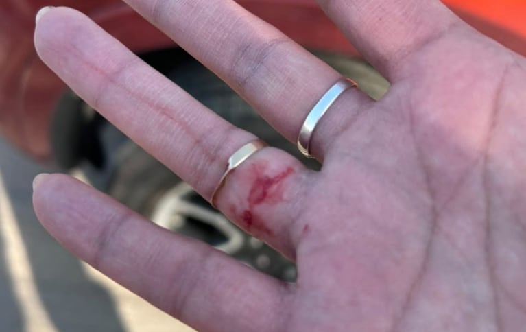 Detuvieron a una mujer de Buenos Aires que se enojó por un control, atacó a la Caminera y huyó