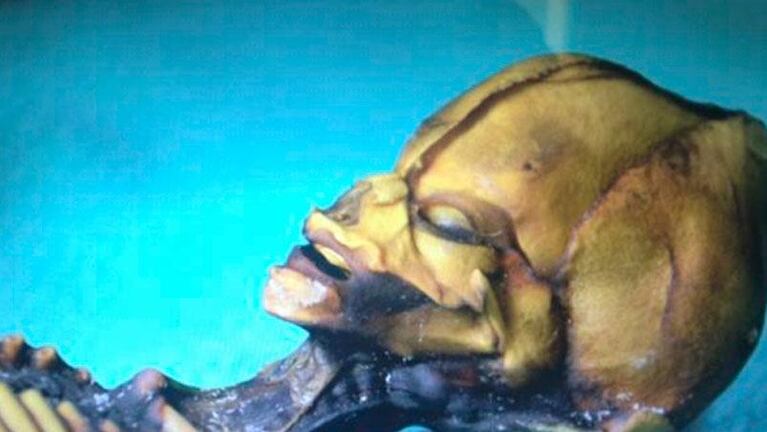 Develaron el misterio de la "momia extraterrestre" encontrada en Chile