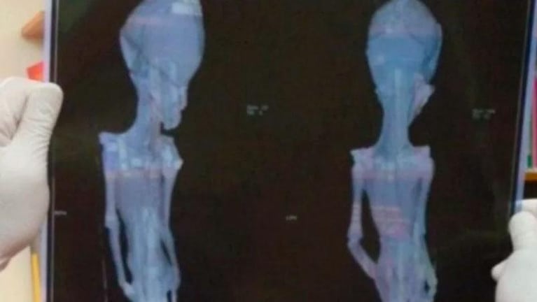 Develaron el misterio de la "momia extraterrestre" encontrada en Chile