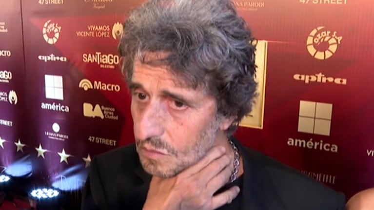 Diego Peretti permanece internado.
