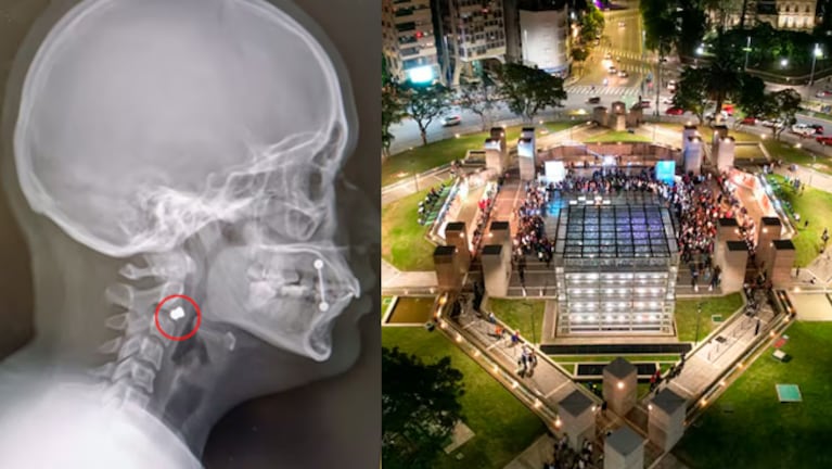 Disparaban balines desde un edificio de Plaza España y una joven terminó con un proyectil alojado en la mandíbula.