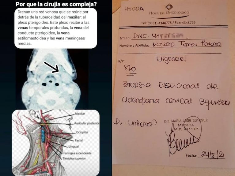 Dramático pedido de una joven tatuadora: busca que le salven la vida