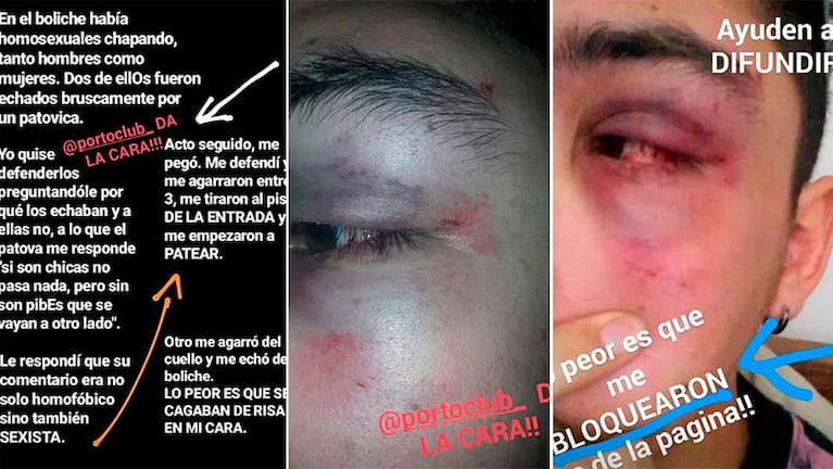 Echaron a su amigo gay del boliche, quiso defenderlo y denuncia que lo golpearon