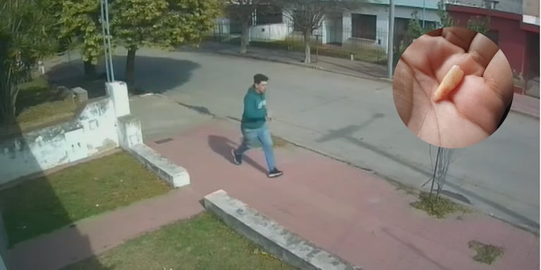 El adolescente fue asaltado cuando salió a hacer las compras y perdió varios dientes.