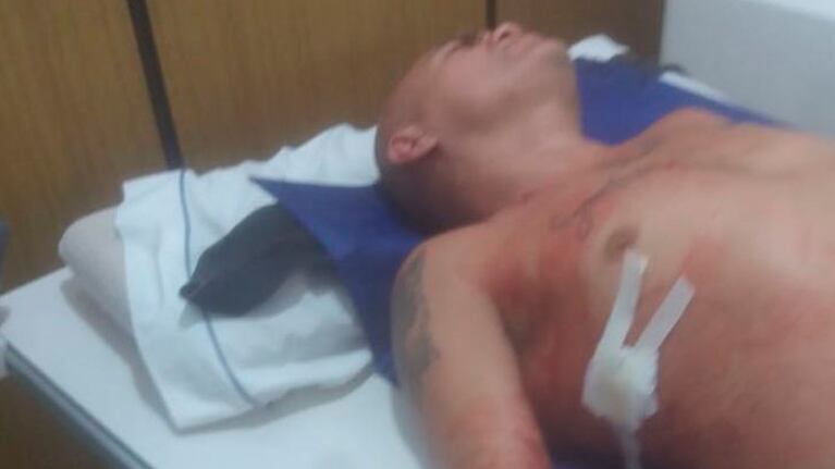 El agresor fue identificado y es oriundo de Tigre.