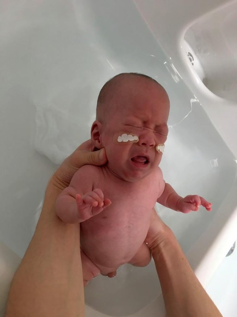El bebé más pequeño del mundo sobrevivió al parto y ya recibió el alta médica