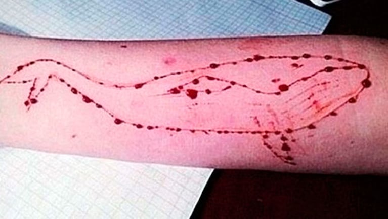 El brazo de una de las participantes de “La ballena azul”. 