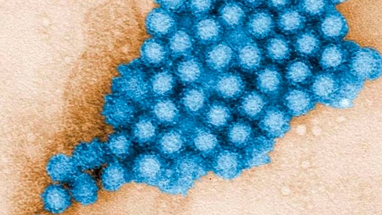 El brote de norovirus elevó la cantidad de casos a cifras que no se registraban desde hace 5 años.