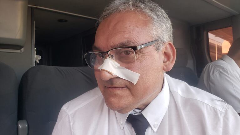 El chofer sufrió un corte en la cara.
