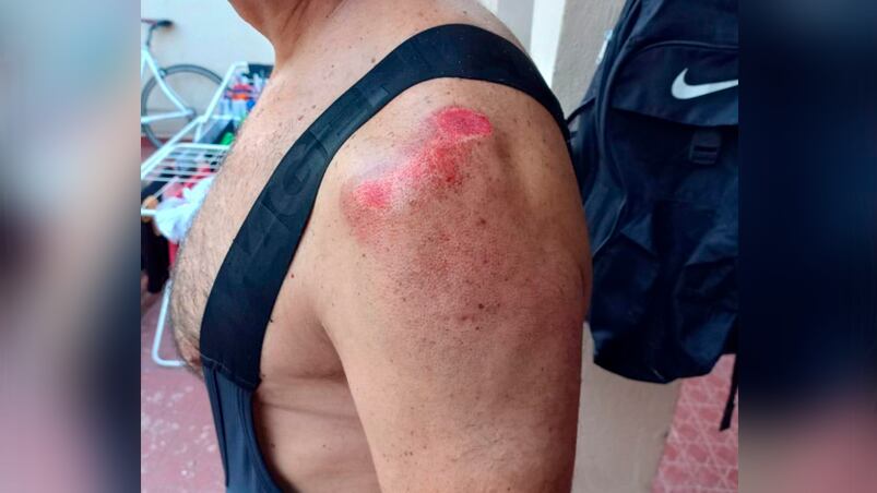 El ciclista sufrió todo tipo de lesiones en el cuerpo.