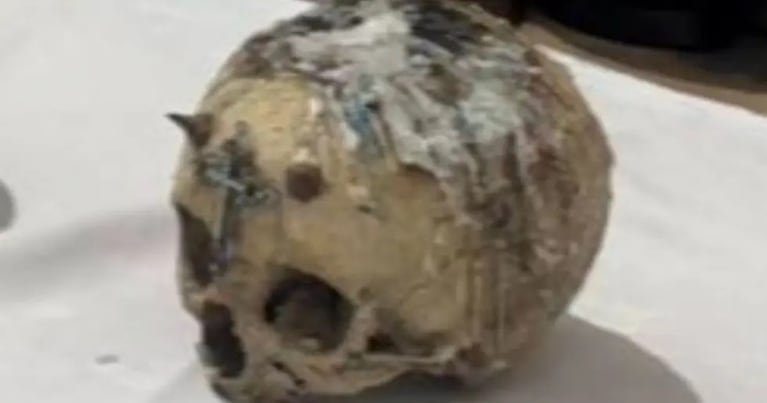 El cráneo con cera derretida hallado en la casa del cultivador (Gentileza Infobae)