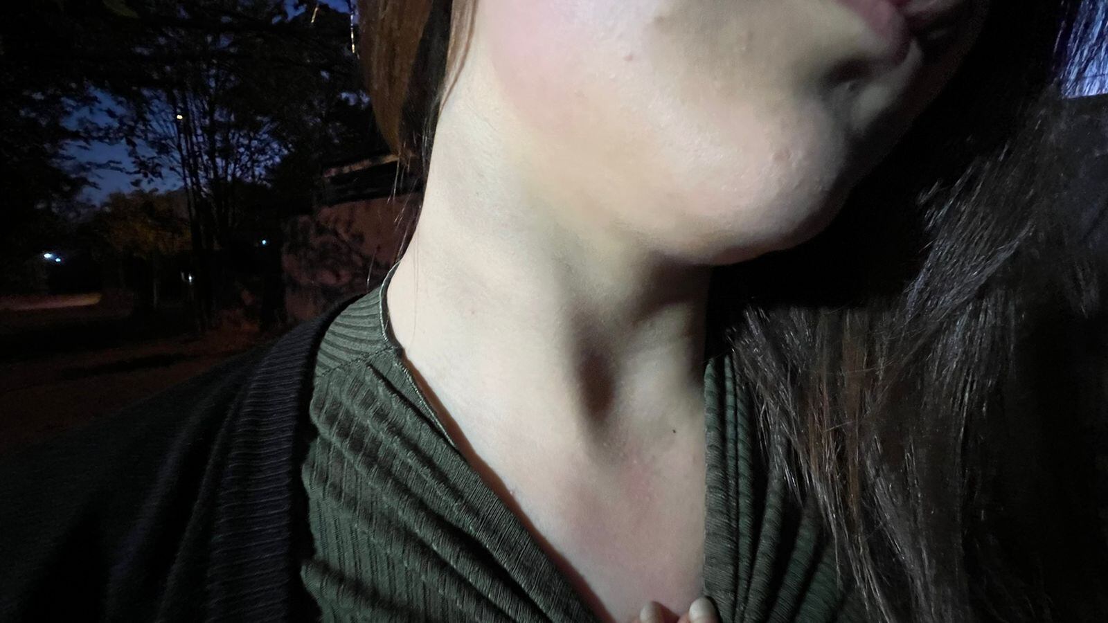 El cuello maltratado de la joven.