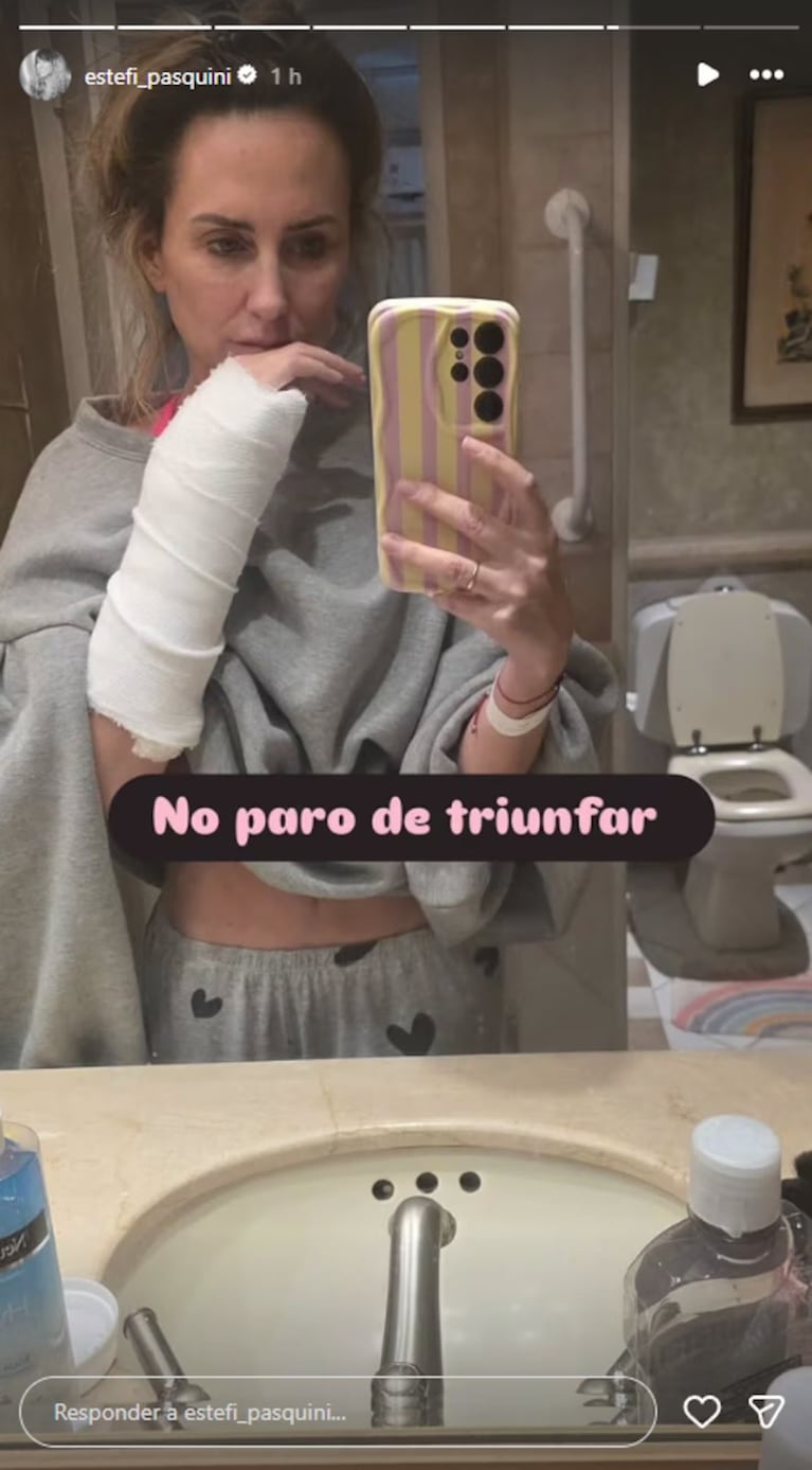 El doloroso accidente doméstico que sufrió Estefanía Pasquini: “Era como un acordeón”