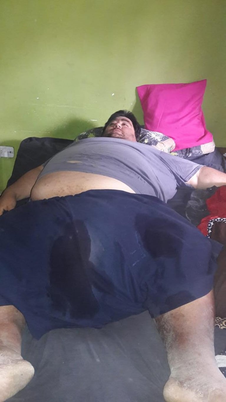 El drama de Jorge: pesa 265 kilos y necesita ayuda 