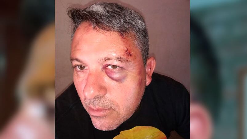 El empresario recibió golpes en su cabeza y su cara terminó muy lesionada.