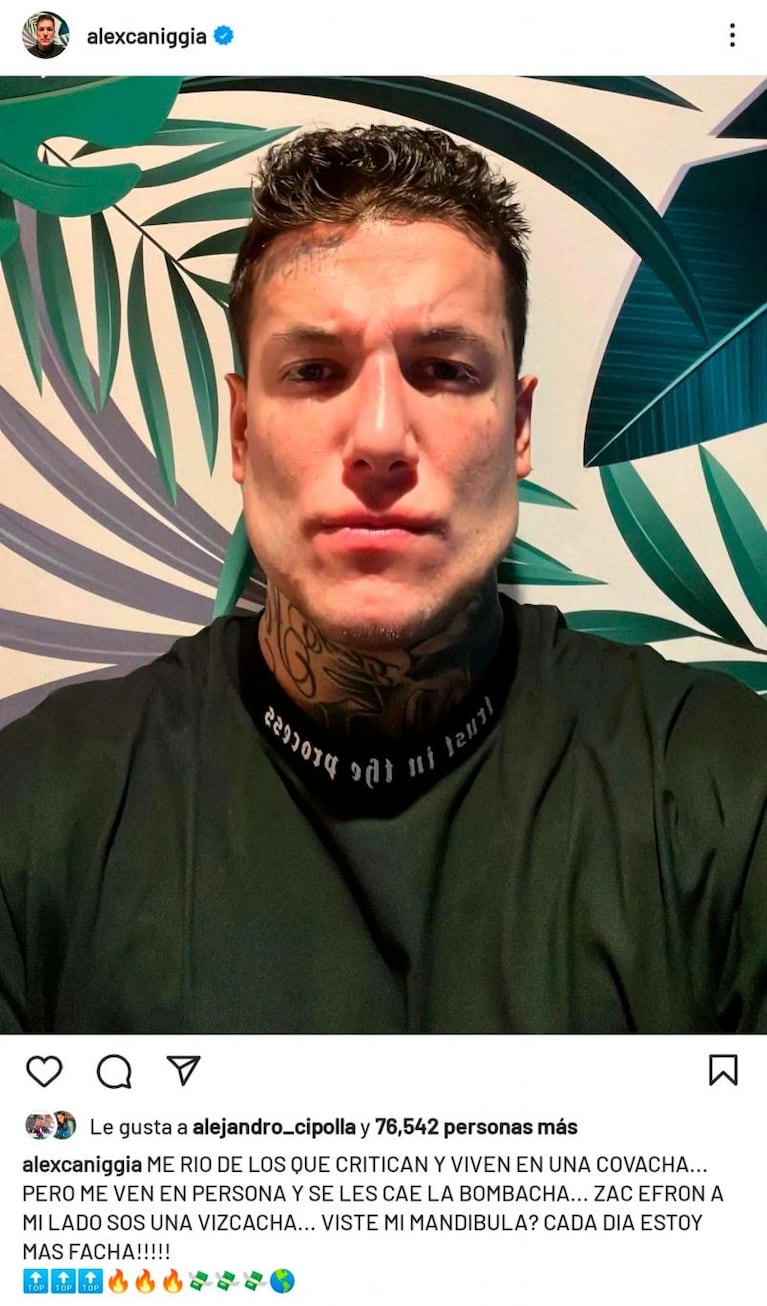 El fulminante mensaje de Alex Caniggia a quienes lo criticaron por su nueva mandíbula