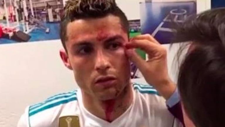 El gesto coqueto de Cristiano Ronaldo al ver su herida