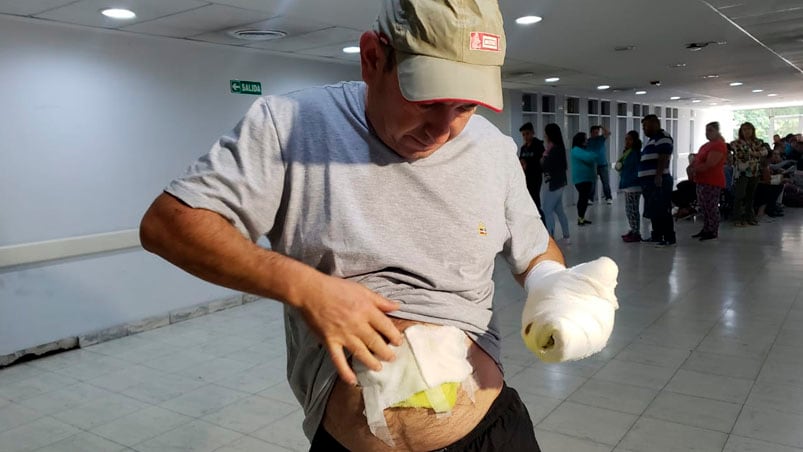 El herido contó que quiso salvar a un sobrino que manipulaba la bomba.