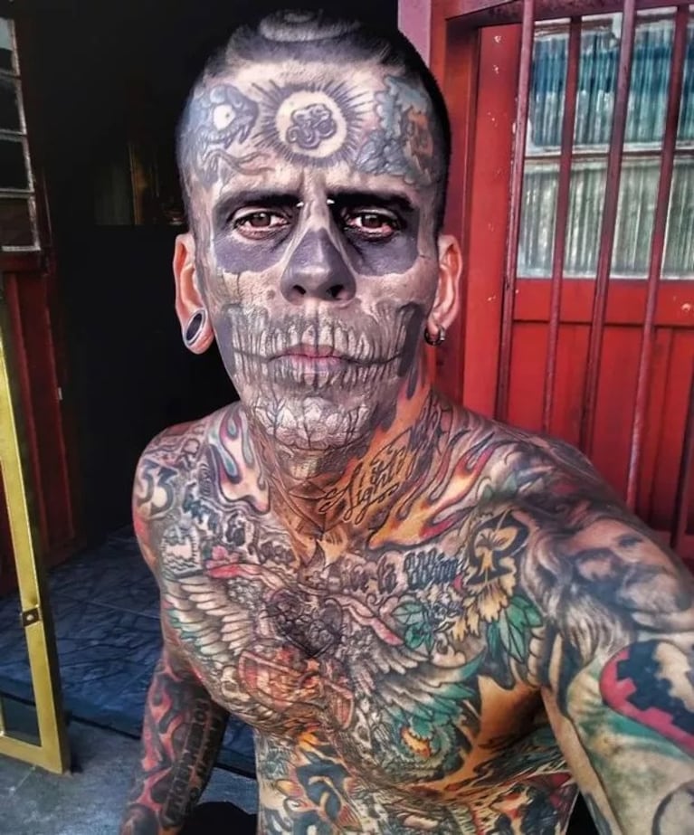 El hombre cubierto por 175 tatuajes decidió sacárselos con una cirugía.