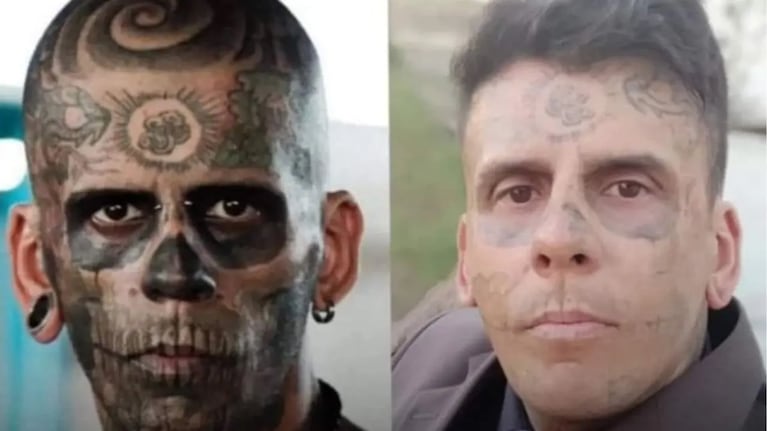 El hombre de 175 tatuajes en su cuerpo hizo un cambio radical a través de cirugías.