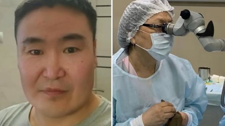 El hombre era un soldador y sufrió por meses dolor de cabeza.