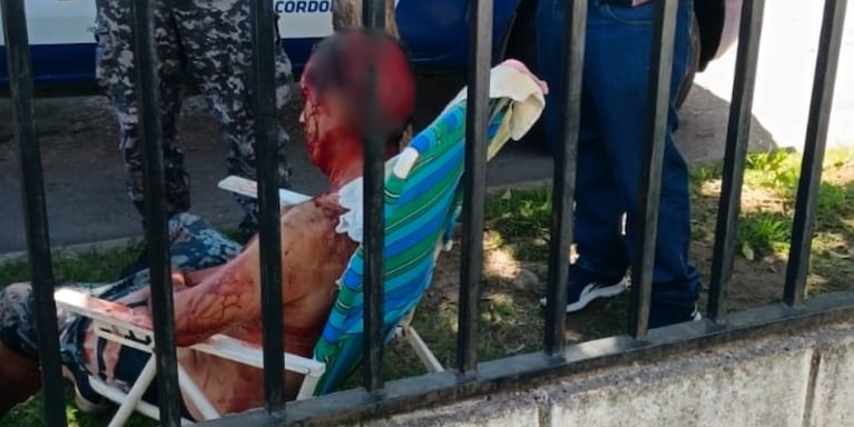 El hombre fue atacado por un perro y sufrió terribles lesiones en la cabeza.