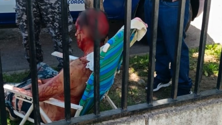 El hombre fue atacado por un perro y sufrió terribles lesiones en la cabeza.
